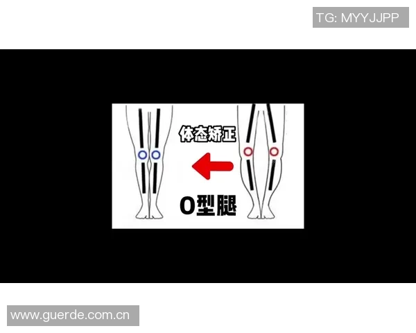 足球明星们的O型腿现象揭秘与影响分析